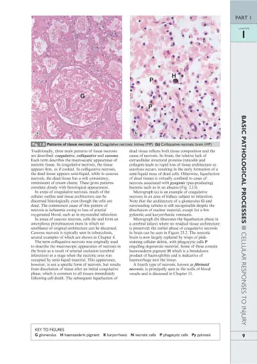 Wheater's Basic Pathology: A Text, Atlas, and Review of Histopathology. International Edition, 5th Edition - фото 12