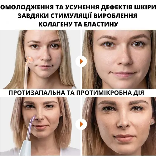 Дарсонваль AIMED Classic Edition с 4 насадками цвет белый - фото 6