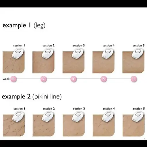 Жіночий лазерний епілятор для всього тіла, технологія IPL - фото 5