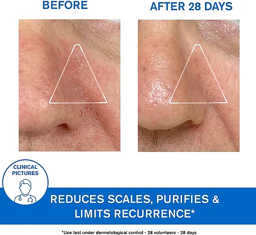 Заспокійлива емульсія Uriage DS Regulating Soothing Emulsion проти себорейного дерматиту 40 мл - фото 7