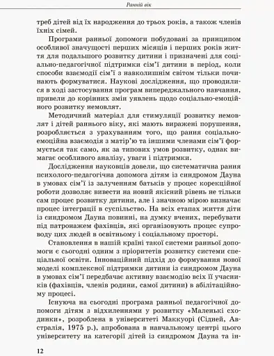 Дитина із синдромом Дауна - фото 8