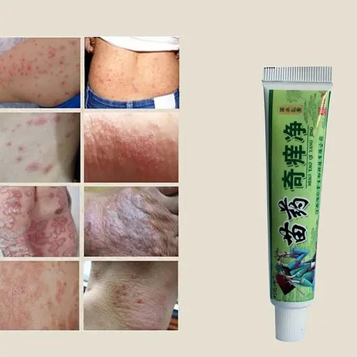 Крем от псориаза Hmong 15 г - фото 3