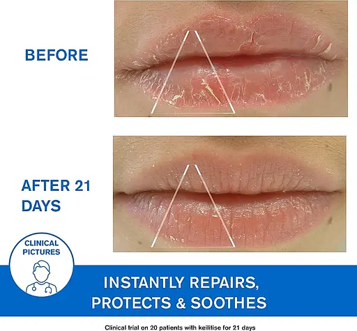 Заспокійлива емульсія Uriage DS Regulating Soothing Emulsion проти себорейного дерматиту 40 мл - фото 6