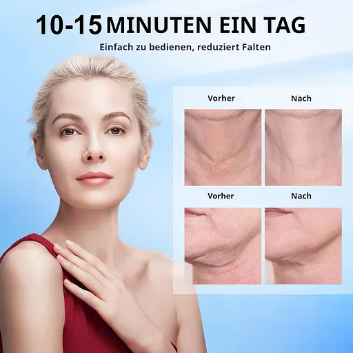 Масажер для обличчя Demine для видалення зморшок з нагріванням та холодними компресами - фото 3