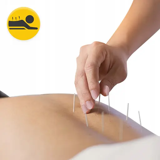 Голки акупунктурні 4FIZJO 0.3 х 60 мм з направляючою 100 шт (P-5905973405096) - фото 8