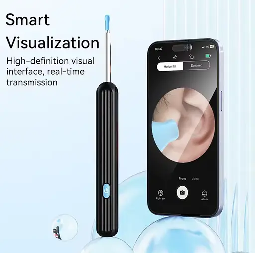 Бездротовий очисник вушної сірки з камерою, безпечний ендоскоп для видалення вушної сірки з камерою - фото 5