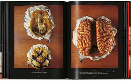 Anatomical Waxes. 45th Edition - фото 20