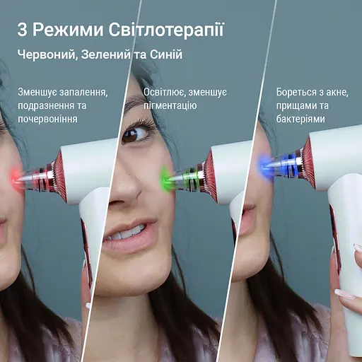 Очищувач шкіри та пор AIMED Pore Cleaner Hot&Cold вакуумний колір білий - фото 4