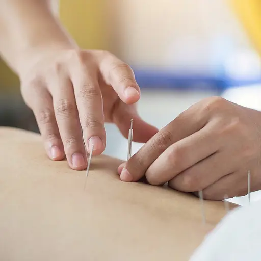 Иглы акупунктурные 4FIZJO 0.25 х 15 мм с направляющей 100 шт 4FJ0554 (P-5907739318923) - фото 6