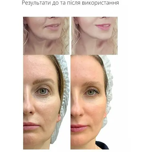 Мікрострумовий ліфтинг-масажер для тіла Medica+ Skin Lifting 5.0   - фото 6