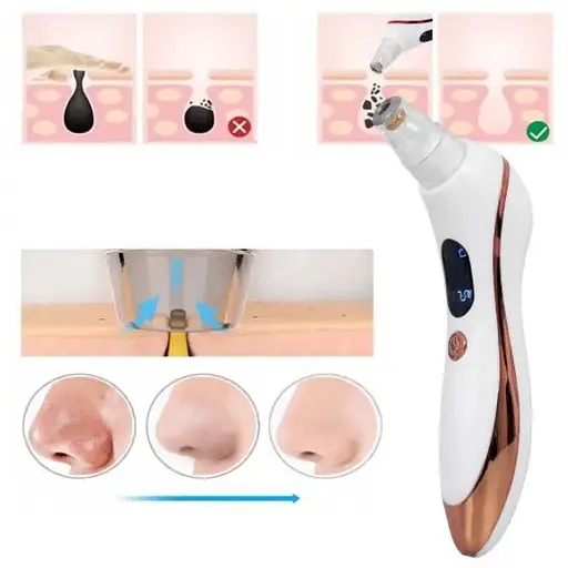 Очищувач шкіри BSE BS-810 вакуумний від чорних крапок - фото 6