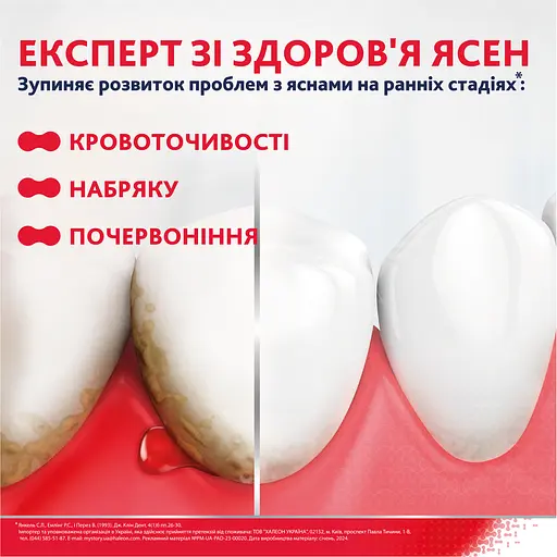 Зубная паста Parodontax Отбеливание 150 мл (2 шт. х 75 мл) - фото 4