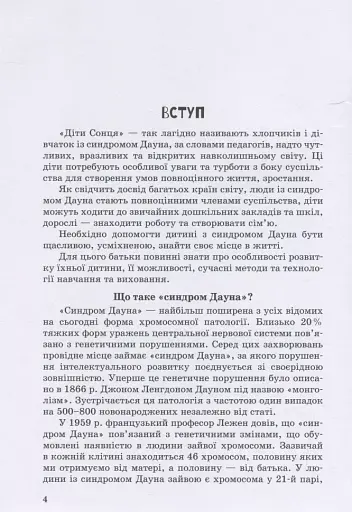 Дитина із синдромом Дауна - фото 3