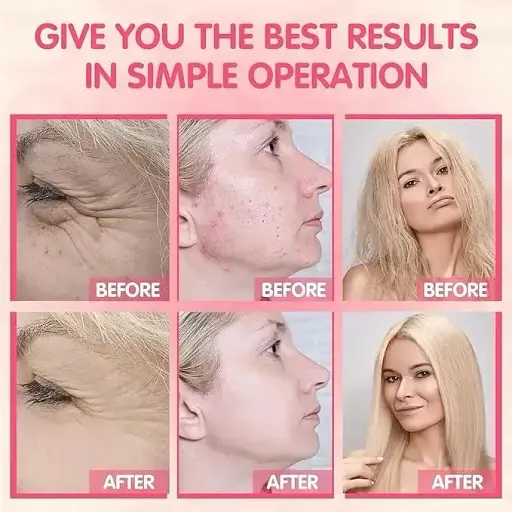 Дарсонваль TUMAKOU F08 Професійний косметологічний апарат для догляду за шкірою обличчя й тіла 4 насадки - фото 4