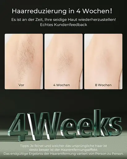 Сверхбыстрое лазерное устройство для удаления волос с революционной технологией IGBT 19,8J Эффективный IPL для женщин и мужчин - фото 3