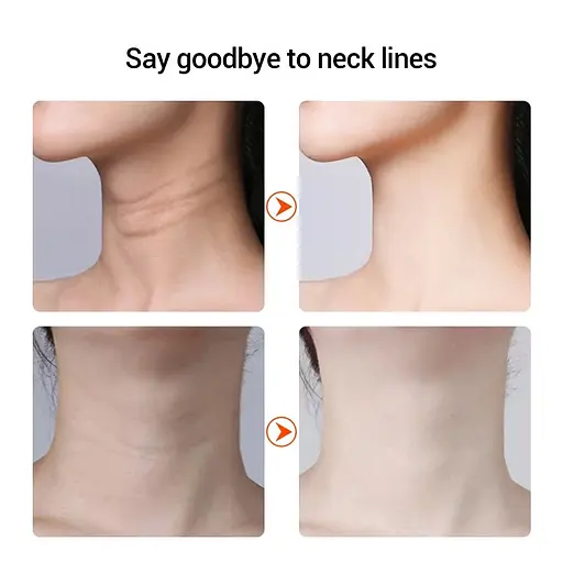 Микротоковый массажер Neck Beauty Device для шеи и лица - фото 4
