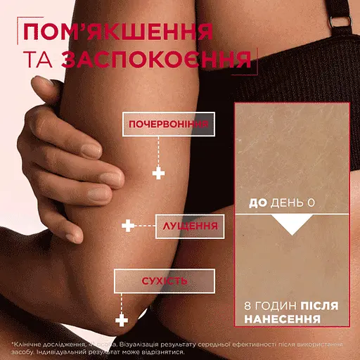 Крем Mixa Urea Cica Repair для сухої огрубілої шкіри обличчя рук і тіла відновлювальний 400 мл - фото 3