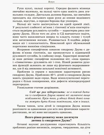 Дитина із синдромом Дауна - фото 3