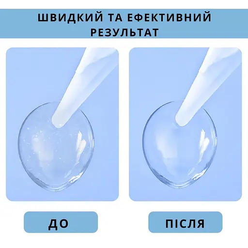 Ультразвуковой контейнер для очистки контактных линз AIMED Lens Master с таймером дней и зеркалом - фото 2