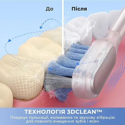 Електрична зубна щітка Mova Fresh Pro Sliver (ATB15A-SIL) - фото 7