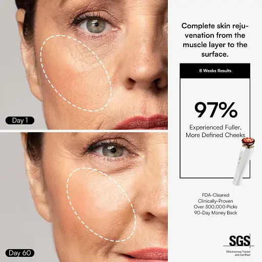 Микротоковое устройство для лица INIA FLARE - фото 4