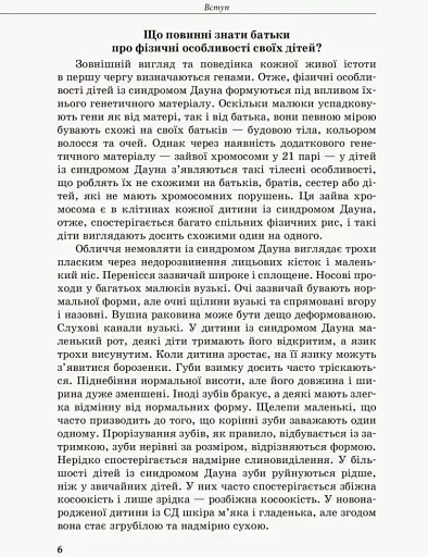 Дитина із синдромом Дауна - фото 2