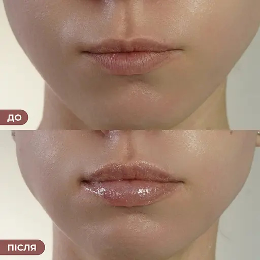 Бальзам-блеск для губ Sparkling Kiss Hillary 10 мл - фото 4