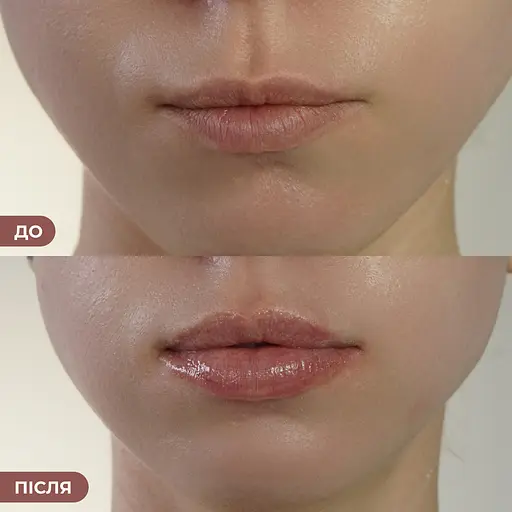 Бальзам-блиск для губ Elegance Rosé Elixir Hillary 10 мл - фото 4