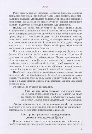 Дитина із синдромом Дауна - фото 6