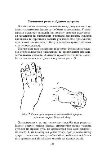 Біль в руках. Отерплість рук. Що потрібно знати про своє захворювання. - фото 4