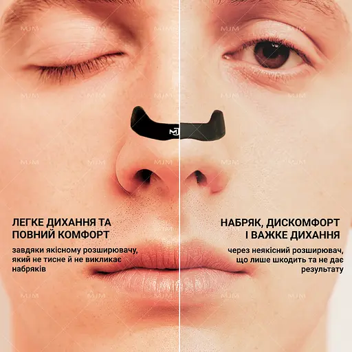 Магнітний розширювач для носа від хропіння MJM | 15 днів - фото 2