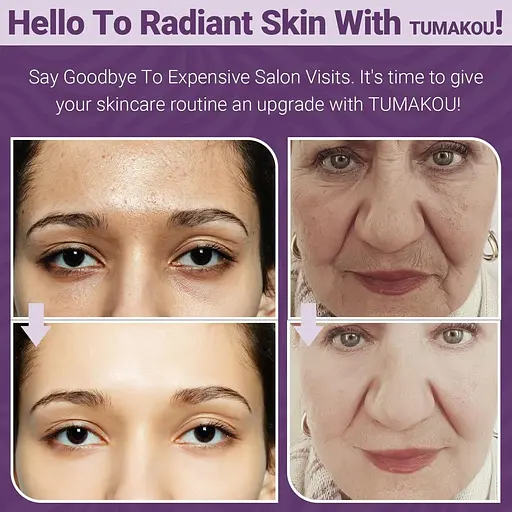 Радіочастотний апарат для підтяжки шкіри TUMAKOU 4 в 1 EMS - фото 4