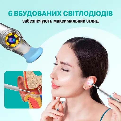 Пристрій для видалення вушної сірки з камерою з отоскопом Bebird X0 1080P Black - фото 8