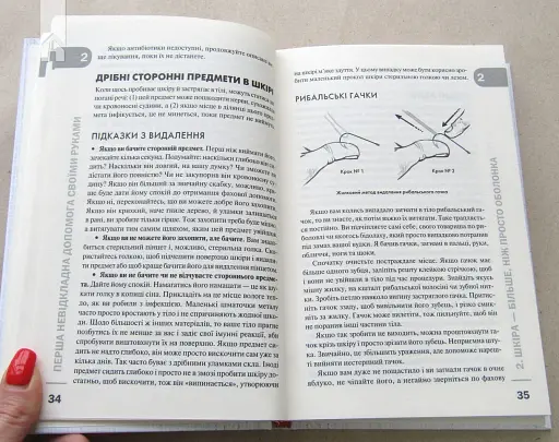 Перша невідкладна допомога своїми руками. Що робити якщо швидка не поспішає - фото 4