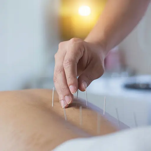 Иглы акупунктурные 4FIZJO 0.25 х 15 мм с направляющей 100 шт 4FJ0554 (P-5907739318923) - фото 12