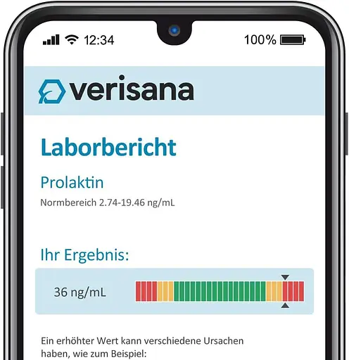 Тест на пролактин для жінок - Розуміння вашого гормонального балансу - Легко виконувати вдома - Verisana - фото 2