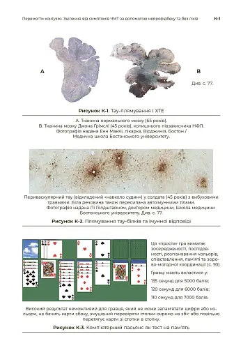 Перемогти контузію. Зцілення від симптомів ЧМТ за допомогою нейрофідбеку та без ліків - фото 12