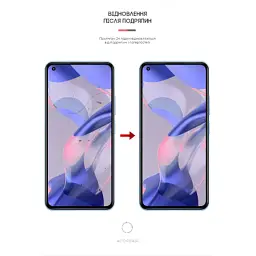 Плівка захисна Armorstandart Xiaomi 11 Lite 5G NE (ARM62840) - мініатюра 3