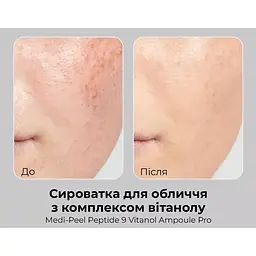 Сироватка для обличчя Medi-Peel Peptide 9 Vitanol Ampoule Pro з пептидами та комплексом вітанолу 30 мл - мініатюра 4