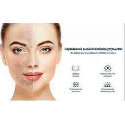 Портативна дарсонваль Medica+ Darsoline 4.0  - мініатюра 6
