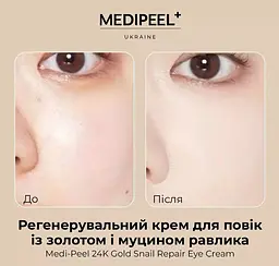 Крем для повік Medi-Peel 24K Gold Snail Repair Eye Cream із золотом та муцином равлика регенерувальний 40 мл - мініатюра 2