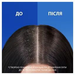 Шампунь проти лупи Head & Shoulders 2 в 1 Цитрусова свіжість 800 мл - мініатюра 4