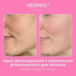 Крем для обличчя Medi-Peel Strogen-Rx II Cream регенерувальний з комплексом фітоестрогенів 30 мл - мініатюра 3