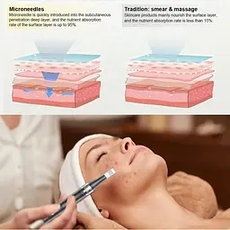 Ручка для мікроголки, електрична ручка PELCAS Derma Pen Акумуляторна регульована швидкість Dermapen мікроголки - мініатюра 4