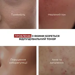 Набір Hillary із кислотами для боротьби з сухістю та лущенням шкіри - мініатюра 3