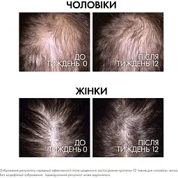 Уцінка. Сироватка Vichy Dercos Aminexil Clinical Regen Booster для відновлення густоти та боротьби з випадінням волосся 90 мл - мініатюра 4