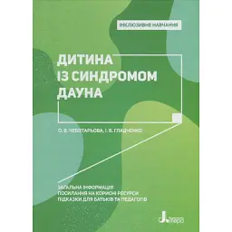 Дитина із синдромом Дауна - Ірина Гладченко