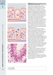Wheater's Basic Pathology: A Text, Atlas, and Review of Histopathology. International Edition, 5th Edition - мініатюра 13
