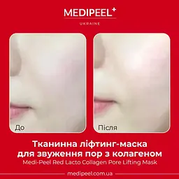 Тканинна ліфтинг-маска Medi Peel Red Lacto Collagen Pore Lifting Mask для звуження пор з колагеном 30 мл - мініатюра 2