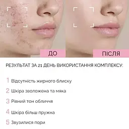 Зволожуючий тонік для обличчя з ніацинамідом Reclaire cosmetics 100 мл - мініатюра 4
